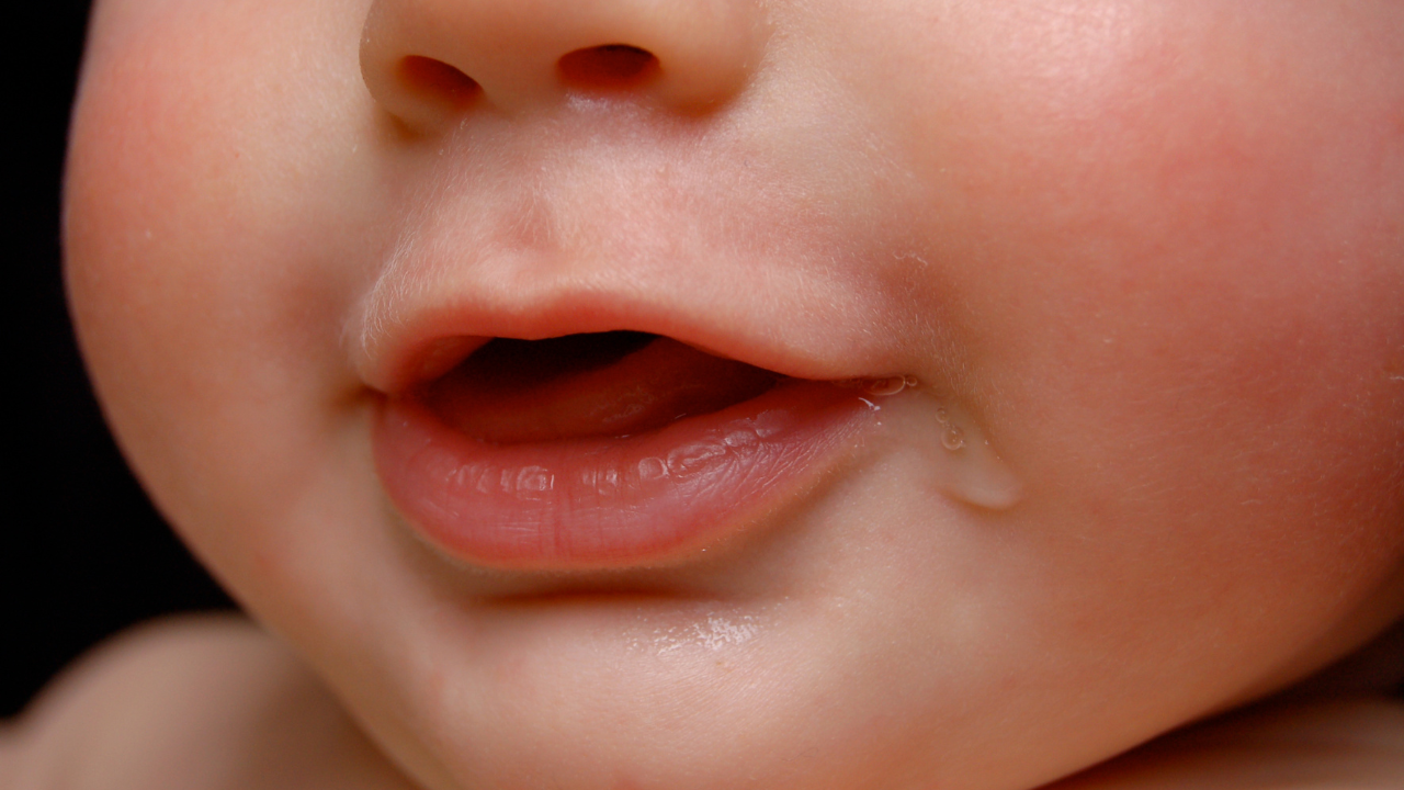 よだれかぶれとは？ 症状や要因は？