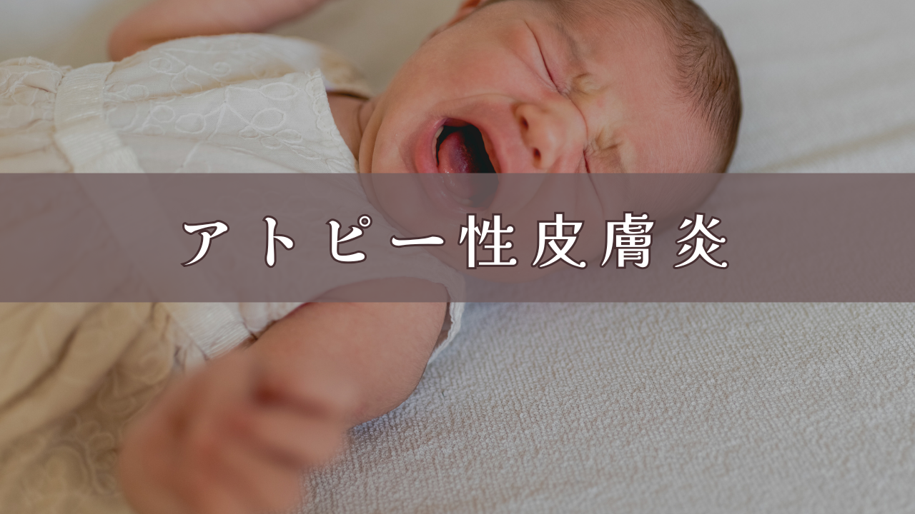 アトピー性皮膚炎